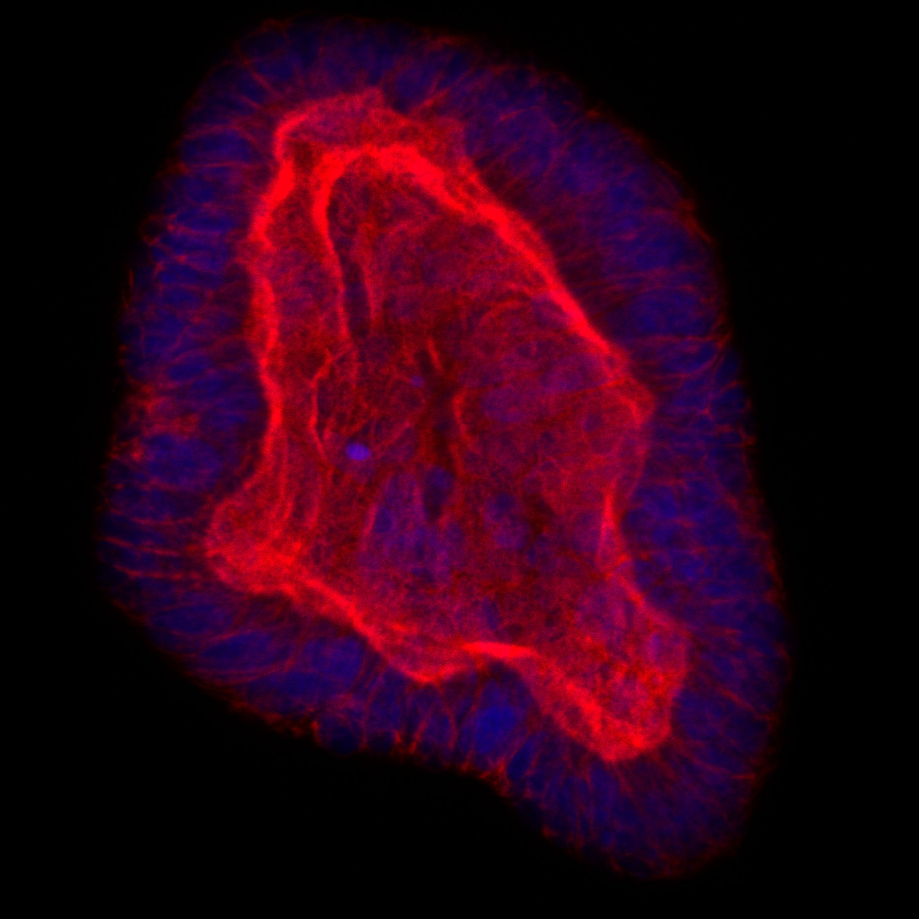Cystic Fibrosis Research Lab